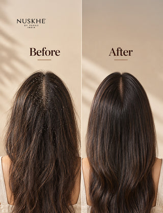 Coco Cleanse Anti-Dandruff Shampoo