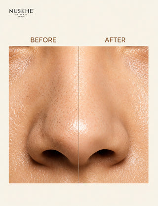 Nose Peel Off Mask