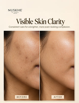 Pigmentation Free Combo