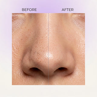 Nose Serum