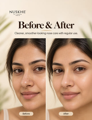 Nose Peel Off Mask