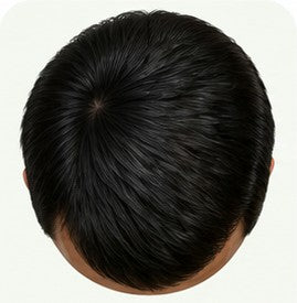Stage 1