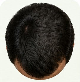 Stage 2