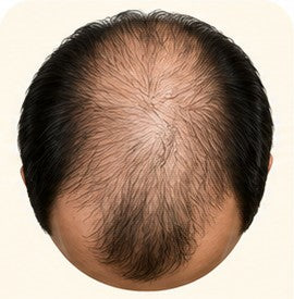 Stage 5