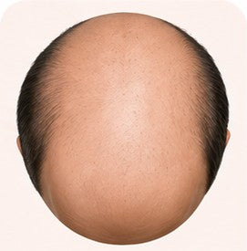 Stage 7